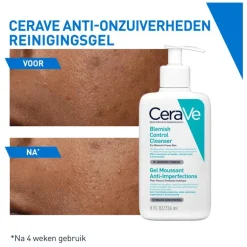 CeraVe Anti-Onzuiverheden Reinigingsgel 473 ML