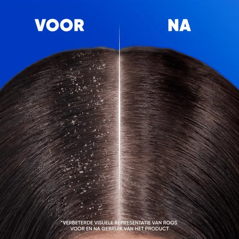 Head & Shoulders Classic Anti-roos Shampoo 300 ML