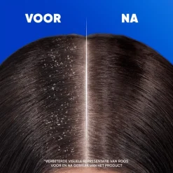 Head & Shoulders Menthol Fresh Anti-Roos Shampoo 300 ML