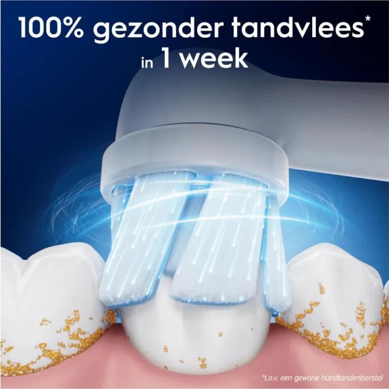 Oral-B iO Gentle Care Opzetborstels Zwart 4 Stuks
